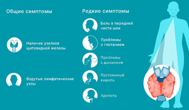 Онкология рак щитовидной железы презентация