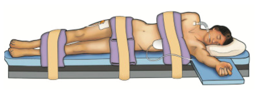 Укладка пациента при роботической операции на почке