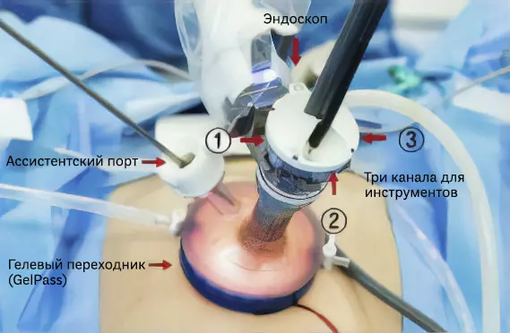 Робот да Винчи СП, докинг