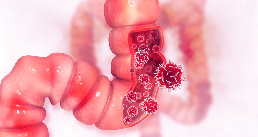 Intuitive Colon Channel