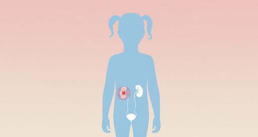 Роботическая хирургия в детской гинекологии: достижения российских врачей