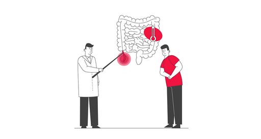 Колпроктэктомия