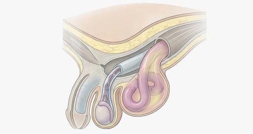 Крурорафия