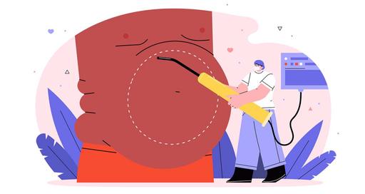 Лапароскопия